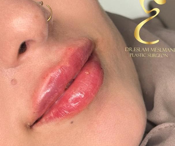 صورة منشأة Dr Eslam Ahmed Al_Meslmani👩🏻⚕️ - قسم عيادات تجميل جراحي في أبو رمانة 2
