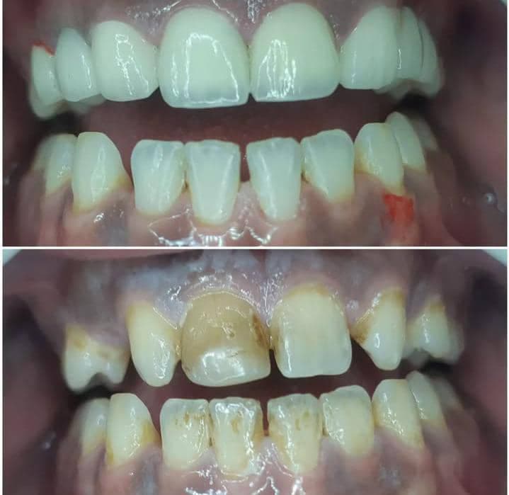 صورة منشأة د.علاء باسل القهوحي - قسم عيادات الأسنان التجميلية في الميدان 5