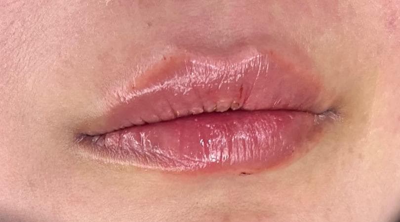 صورة منشأة Dr Eslam Ahmed Al_Meslmani👩🏻⚕️ - قسم عيادات تجميل جراحي في أبو رمانة 4