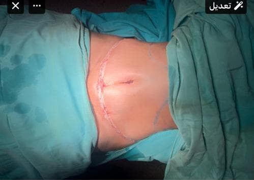 صورة منشأة Dr Eslam Ahmed Al_Meslmani👩🏻⚕️ - قسم عيادات تجميل جراحي في أبو رمانة 10