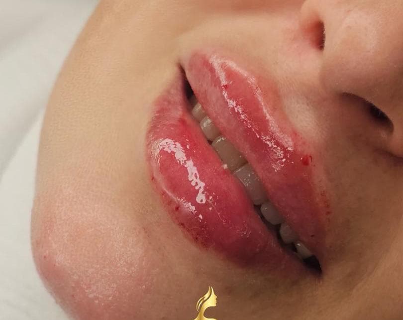 صورة منشأة Dr Eslam Ahmed Al_Meslmani👩🏻⚕️ - قسم عيادات تجميل جراحي في أبو رمانة 1