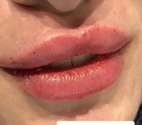صورة منشأة Dr Eslam Ahmed Al_Meslmani👩🏻⚕️ - قسم عيادات تجميل جراحي في أبو رمانة 5