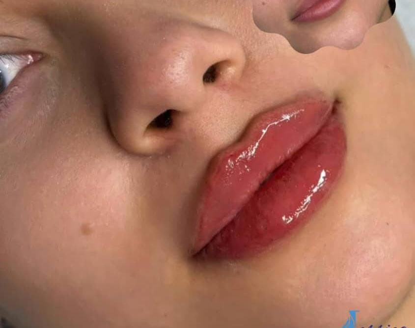 صورة منشأة عيادة جيسيكا التجميلية - قسم عيادات تجميل جراحي في جرمانا 10