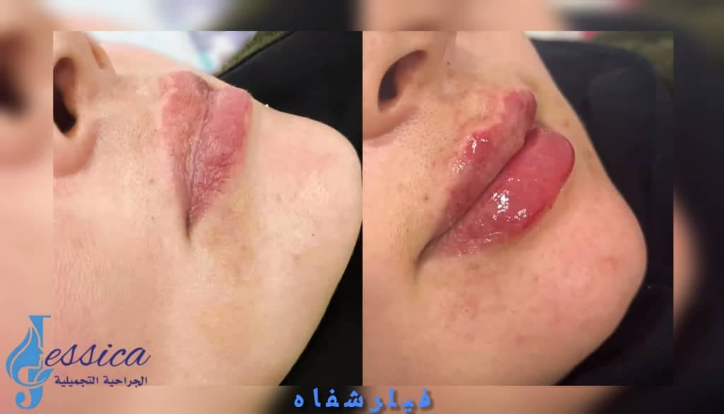 صورة منشأة عيادة جيسيكا التجميلية - قسم عيادات تجميل جراحي في جرمانا 7