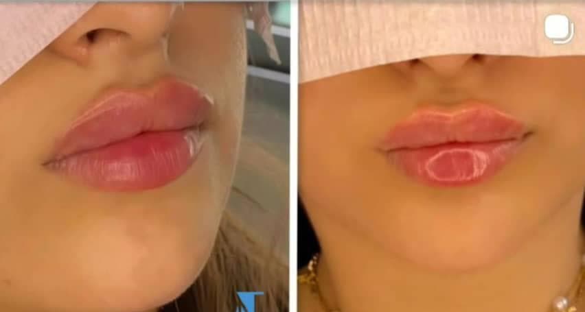 صورة منشأة عيادة جيسيكا التجميلية - قسم عيادات تجميل جراحي في جرمانا 9