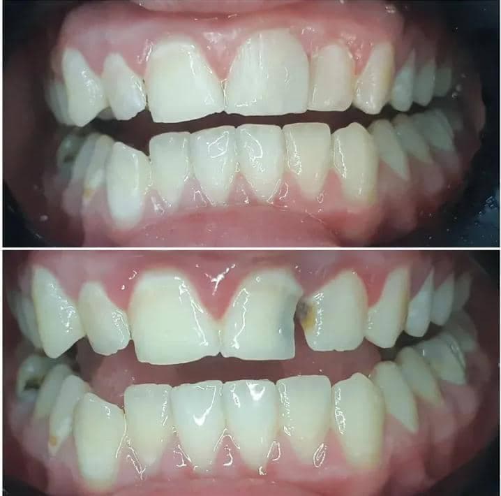 صورة منشأة د.علاء باسل القهوحي - قسم عيادات الأسنان التجميلية في الميدان 2
